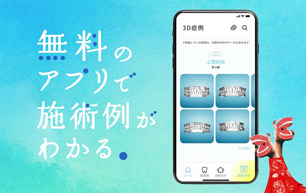 キレイライン矯正