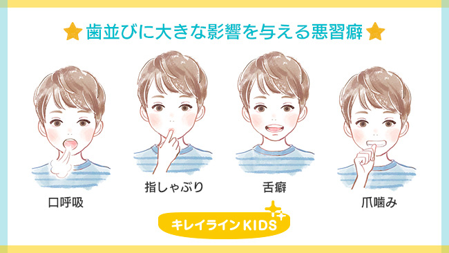 歯並びに影響を与える悪習癖(口呼吸、指しゃぶり、舌癖、爪噛み)